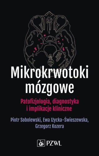 Mikrokrwotoki mózgowe. Patofizjologia,...