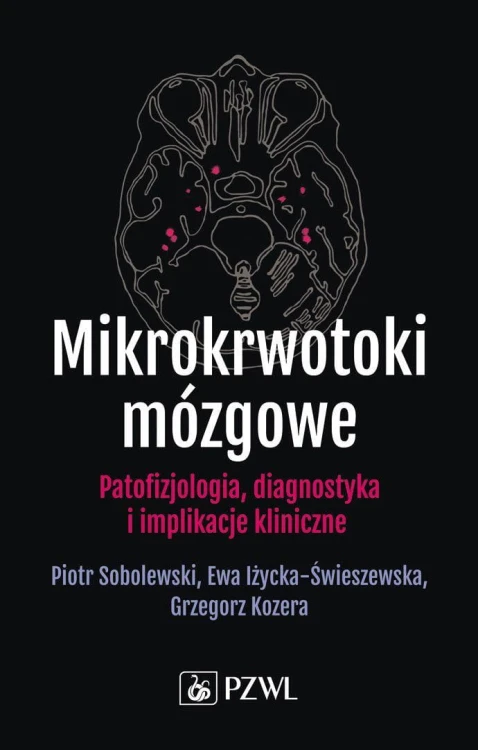 Mikrokrwotoki mózgowe. Patofizjologia,...