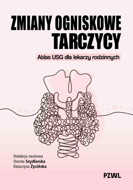 Zmiany ogniskowe tarczycy. Atlas USG dla...