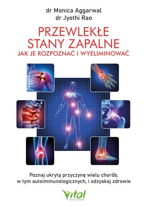 Przewlekłe stany zapalne. Jak je rozpoznać i...