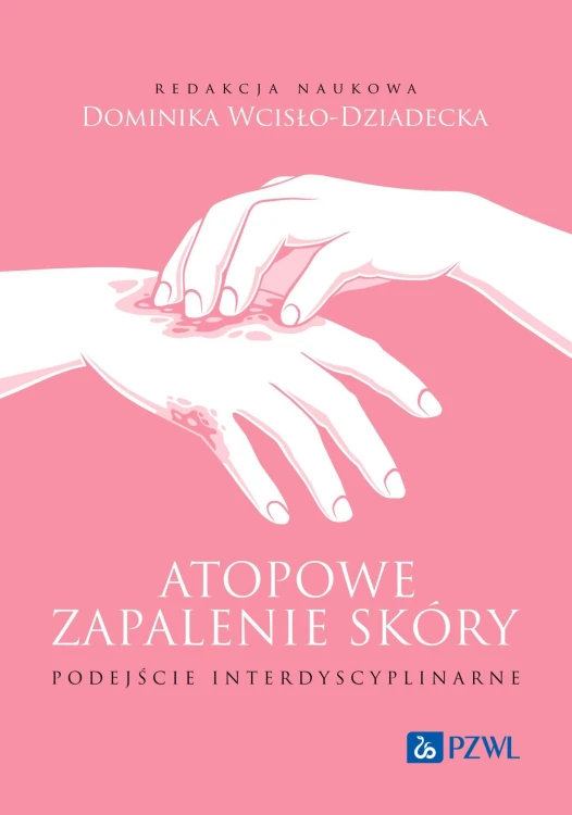 Atopowe zapalenie skóry. Podejście...