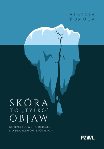Skóra to „tylko” objaw. Kompleksowe podejście...