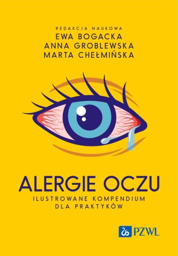 Alergie oczu. Ilustrowane kompendium dla praktyków