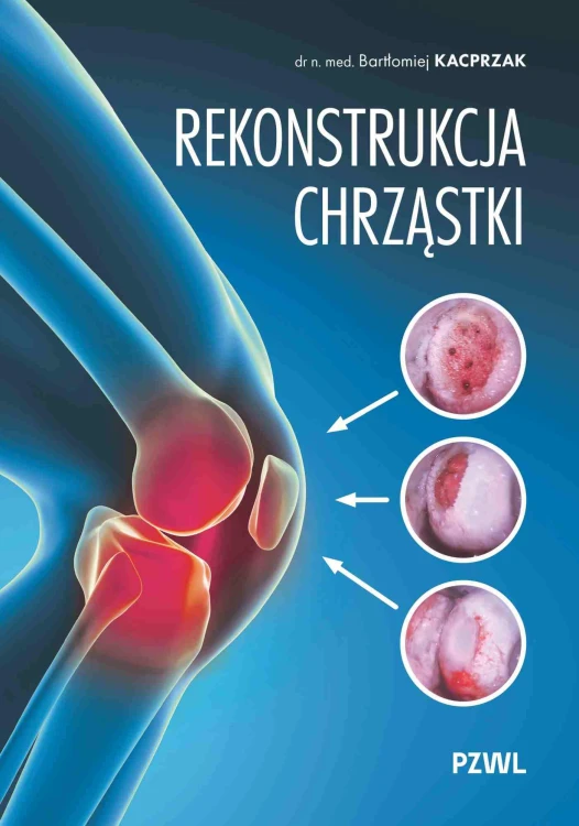 Rekonstrukcja chrząstki. Ratujemy kolano, nie...