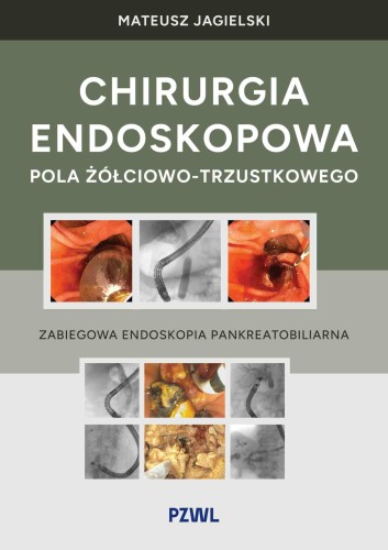 Chirurgia endoskopowa pola...