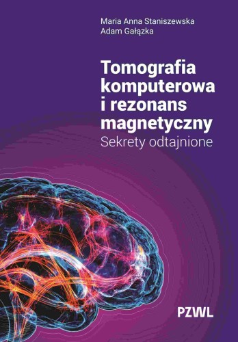 Tomografia komputerowa i rezonans magnetyczny....