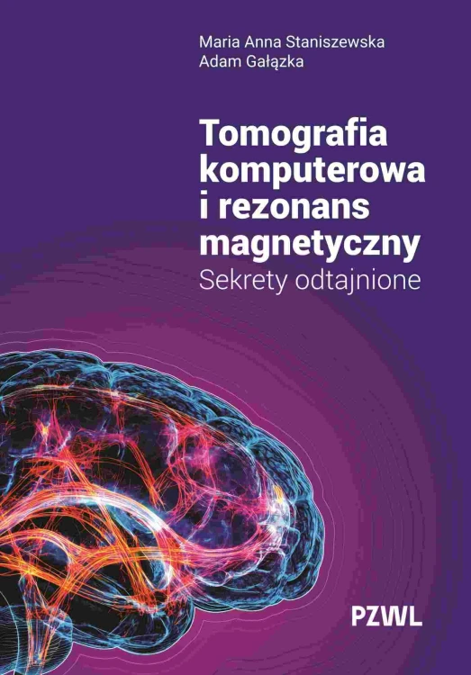 Tomografia komputerowa i rezonans magnetyczny....