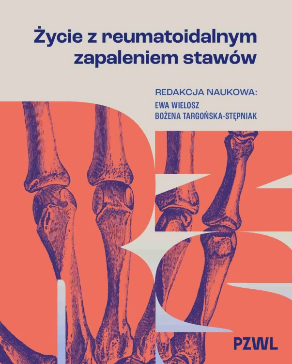 Życie z reumatoidalnym zapaleniem stawów