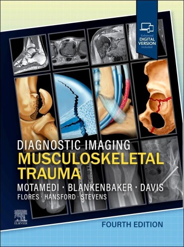 Diagnostic Imaging. Musculoskeletal Trauma